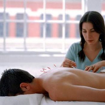 Can Acupuncture Improve Your Workout?