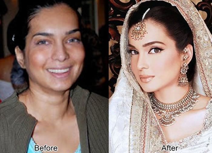 Amina Haq Before and After Plastic Surgery