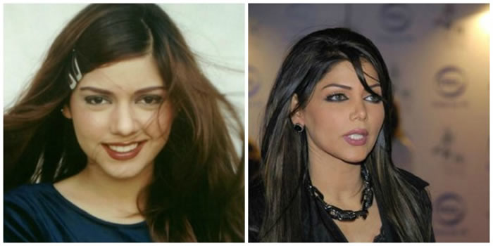 Hadiqa Kiani Before and After Plastic Surgery
