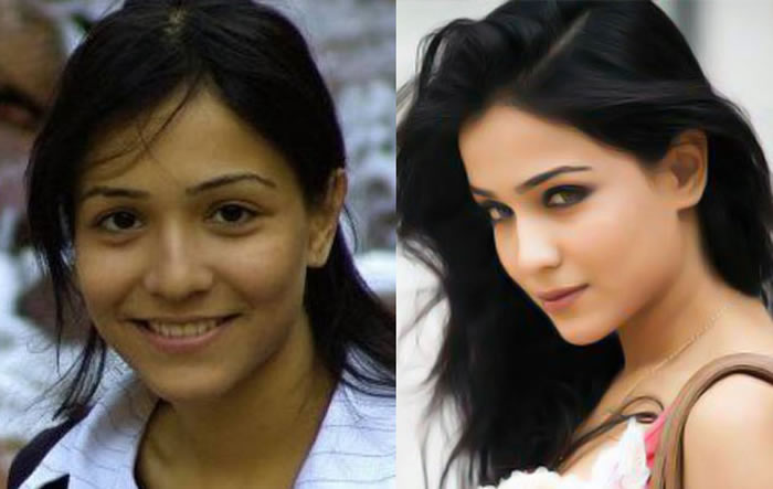 Humaima Malik and After Plastic Surgery