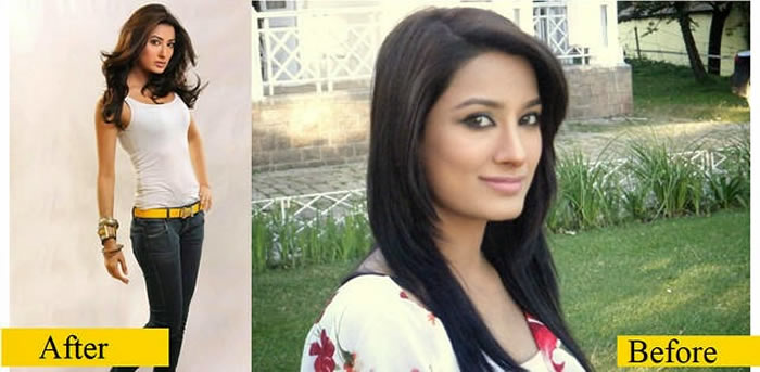 Mehwish Hayat Before and After Plastic Surgery