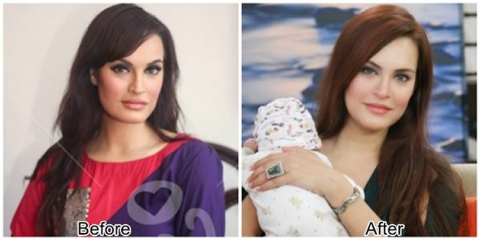 Nadia Hussain Before and After Plastic Surgery