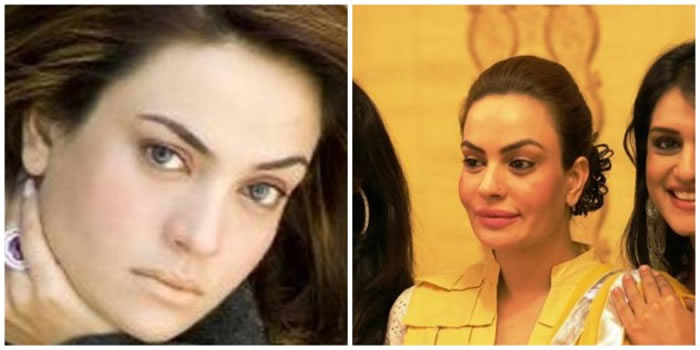 Sadia Imam Before and After Plastic Surgery