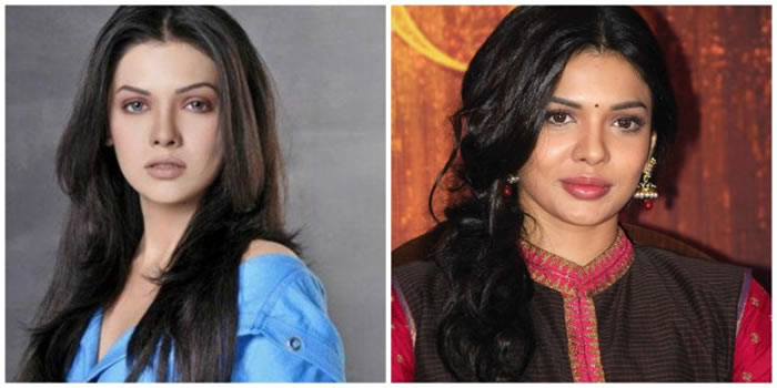 Sara Loren Before and After Plastic Surgery