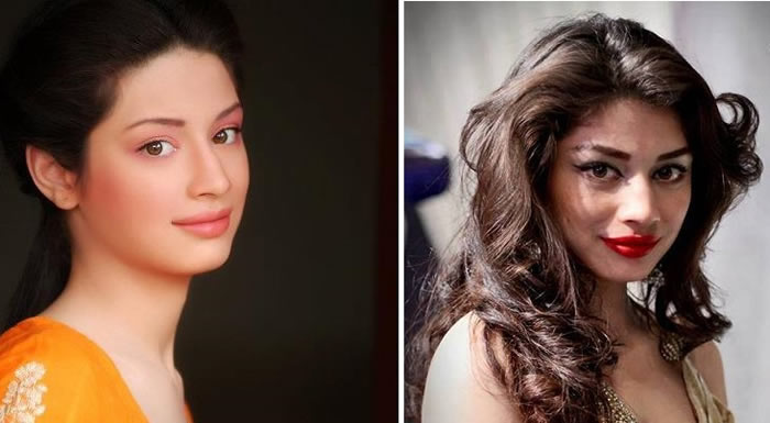 Sidra Batool and After Plastic Surgery