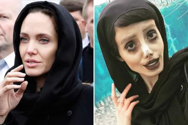 Iranian Teenage Girl Undergoes 50 Surgeries to Look Like Angelina Jolie!