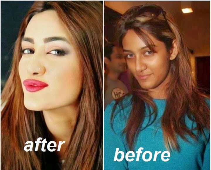 glutathione before and after celebrity